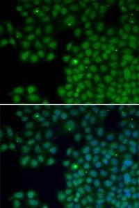 Immunofluorescence analysis of HeLa cells using Anti-NUDT6 Antibody (A0260). Blue: DAPI for nuclear staining.