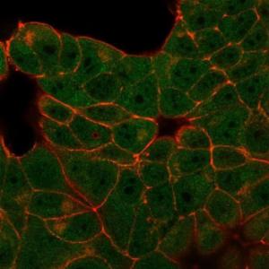 Immunofluorescent analysis of PFA fixed MCF-7 cells stained with Anti-E4F1 Antibody [PCRP-E4F1-2D1] followed by Goat Anti-Mouse IgG (CF&#174; 488) (Green) Counterstain is Phalloidin (Red)