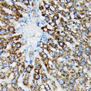 Immunohistochemistry analysis of paraffin-embedded rat liver using Anti-HSPA4 Antibody [ARC2237] (A305695) at a dilution of 1:100 (40x lens). Perform microwave antigen retrieval with 10 mM Tris/EDTA buffer pH 9.0 before commencing with IHC staining protocol.