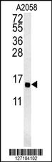 Anti-GOT1A Rabbit Polyclonal Antibody