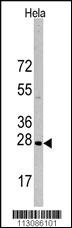 Anti-HSPB1 Rabbit Polyclonal Antibody