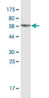 Anti-TUBA4A Mouse Monoclonal Antibody [clone: 2E11]