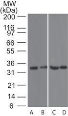 Anti-CVID Rabbit Polyclonal Antibody