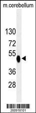 Anti-PDK2 Mouse Monoclonal Antibody [clone: 180CT10.2.3]