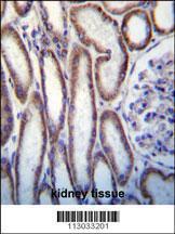 Anti-MUC20 Rabbit Polyclonal Antibody (HRP (Horseradish Peroxidase))