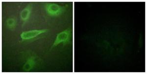 Immunofluorescence analysis of HeLa cells using Anti-IL-4R (phospho Tyr497) Antibody. The right hand panel represents a negative control, where the antibody was pre-incubated with the immunising peptide