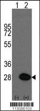 Anti-HSPB1 Rabbit Polyclonal Antibody