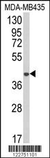 Anti-AGPAT4 Rabbit Polyclonal Antibody