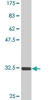 Anti-TGIF2 Mouse Monoclonal Antibody [clone: 4B10]