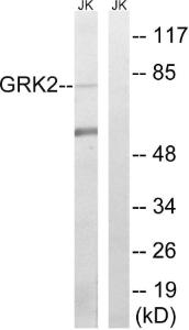 Western blot analysis of lysates from Jurkat cells using Anti-GRK2 Antibody. The right hand lane represents a negative control, where the Antibody is blocked by the immunising peptide