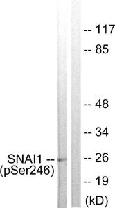 Western blot analysis of lysates from HT29 cells using Anti-SNAI1 (phospho Ser246) Antibody. The right hand lane represents a negative control, where the antibody is blocked by the immunising peptide