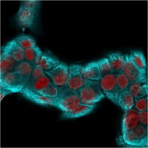 Immunofluorescent analysis of MCF-7 cells stained with Anti-Cytokeratin 18 Antibody [KRT18/2819R] followed by Goat Anti-Rabbit IgG (CF and #174; 488) (Cyan). Nuclei counterstained with RedDot (Red)