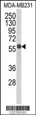 Anti-ALDH3B1 Rabbit Polyclonal Antibody