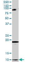 Anti-CLPS Rabbit Polyclonal Antibody