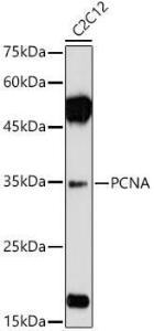 Western blot analysis of extracts of various cell lines, using Anti-PCNA Antibody (A12584) at 1:1,000 dilution. The secondary antibody was Goat Anti-Rabbit IgG H&L Antibody (HRP) at 1:10,000 dilution.