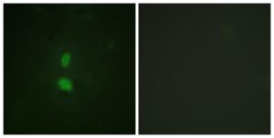 Immunofluorescence analysis of HUVEC cells using Anti-SNAI1 (phospho Ser246) Antibody. The right hand panel represents a negative control, where the antibody was pre-incubated with the immunising peptide