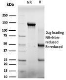 SDS-PAGE analysis of Anti-E4F1 Antibody [PCRP-E4F1-2D1] under non-reduced and reduced conditions; showing intact IgG and intact heavy and light chains, respectively SDS-PAGE analysis confirms the integrity and purity of the antibody