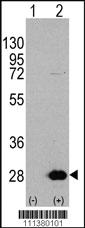 Anti-HSPB1 Rabbit Polyclonal Antibody