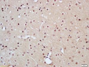 Anti-SLC29A2 Rabbit Polyclonal Antibody