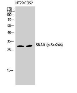 Western blot analysis of HT29 COS7 cells using Anti-SNAI1 (phospho Ser246) Antibody