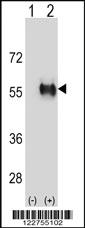 Anti-ALDH3B1 Rabbit Polyclonal Antibody