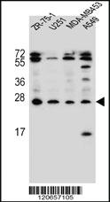 Anti-EDN1 Rabbit Polyclonal Antibody