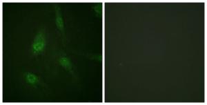 Immunofluorescence analysis of HeLa cells using Anti-NFAT4 (phospho Ser165) Antibody. The right hand panel represents a negative control, where the Antibody was pre-incubated with the immunising peptide