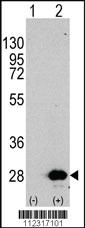 Anti-HSPB1 Rabbit Polyclonal Antibody