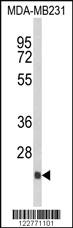 Anti-DERL2 Rabbit Polyclonal Antibody