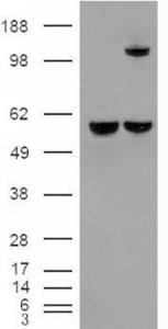 HEK293 overexpressing Insulysin (RC220700) and probed with EB07898 (mock transfection in first lane), tested by Origene.