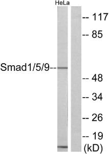 Antibody anti-SMAD1 SMAD5 SMAD9 100 µg