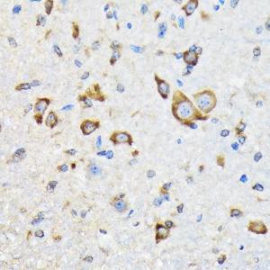 Immunohistochemistry analysis of paraffin-embedded mouse spinal cord using Anti-HSPA4 Antibody [ARC2237] (A305695) at a dilution of 1:100 (40x lens). Perform microwave antigen retrieval with 10 mM Tris/EDTA buffer pH 9.0 before commencing with IHC staining protocol.