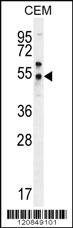 Anti-FOLH1B Rabbit Polyclonal Antibody