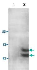 Anti-PARP11 Rabbit Polyclonal Antibody