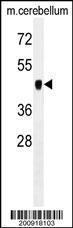 Anti-PDK2 Mouse Monoclonal Antibody (APC (Allophycocyanin)) [clone: 180CT10.2.3]