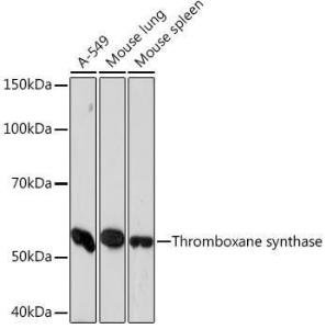 Western blot analysis of extracts of various cell lines, using Anti-Thromboxane synthase Antibody [ARC1189] (A307187) at 1:1,000 dilution. The secondary antibody was Goat Anti-Rabbit IgG H&L Antibody (HRP) at 1:10,000 dilution.