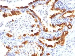 Anti-Cytokeratin 18 antibody