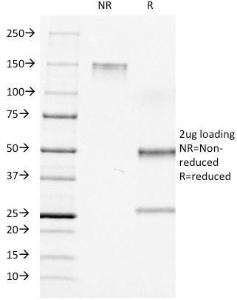 SDS-PAGE analysis of Anti-CD7 Antibody [C7/511] under non-reduced and reduced conditions; showing intact IgG and intact heavy and light chains, respectively. SDS-PAGE analysis confirms the integrity and purity of the antibody