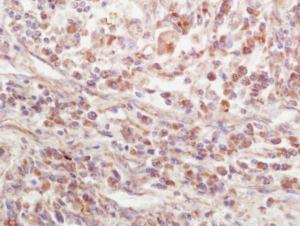 Anti-EPS15L1 Rabbit Polyclonal Antibody