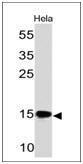 Western blot analysis of HeLa cell lysate using Anti-SUMO-2 + SUMO-3 Antibody [SM23/496]