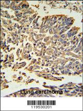 Anti-HSPB1 Rabbit Polyclonal Antibody