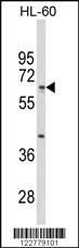 Anti-HSPA6 Rabbit Polyclonal Antibody