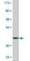 Anti-SRP68 Mouse Monoclonal Antibody [clone: 3A3]