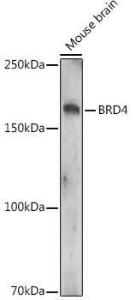 Western blot analysis of extracts of Mouse brain, using Anti-Brd4 (acetyl Lys332) Antibody (A308213) at 1:1000 dilution. The secondary Antibody was Goat Anti-Rabbit IgG H&L Antibody (HRP) at 1:10000 dilution. Lysates/proteins were present at 25 µg per lane