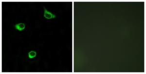 Immunofluorescence analysis of COS7 cells using Anti-FZD6 Antibody. The right hand panel represents a negative control, where the antibody was pre-incubated with the immunising peptide