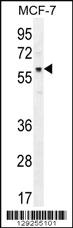 Anti-AKT1 Rabbit Polyclonal Antibody