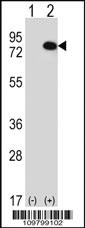 Anti-RIOK1 Rabbit Polyclonal Antibody