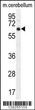 Anti-AKT1 Rabbit Polyclonal Antibody