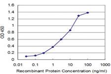 Anti-NEUROG3 Mouse Monoclonal Antibody [clone: 4F6]