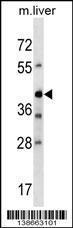 Anti-AVPR1B Rabbit Polyclonal Antibody (FITC (Fluorescein Isothiocyanate))